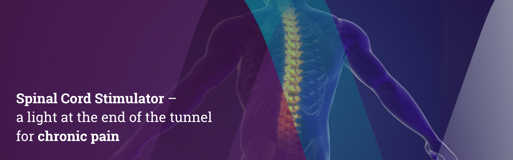Spinal Cord Stimulator – a light at the end of the tunnel for chronic pain