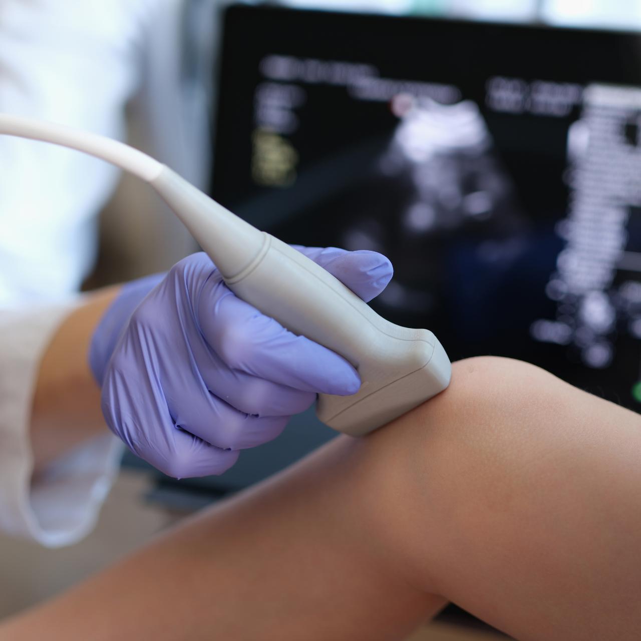 Knee ultrasound